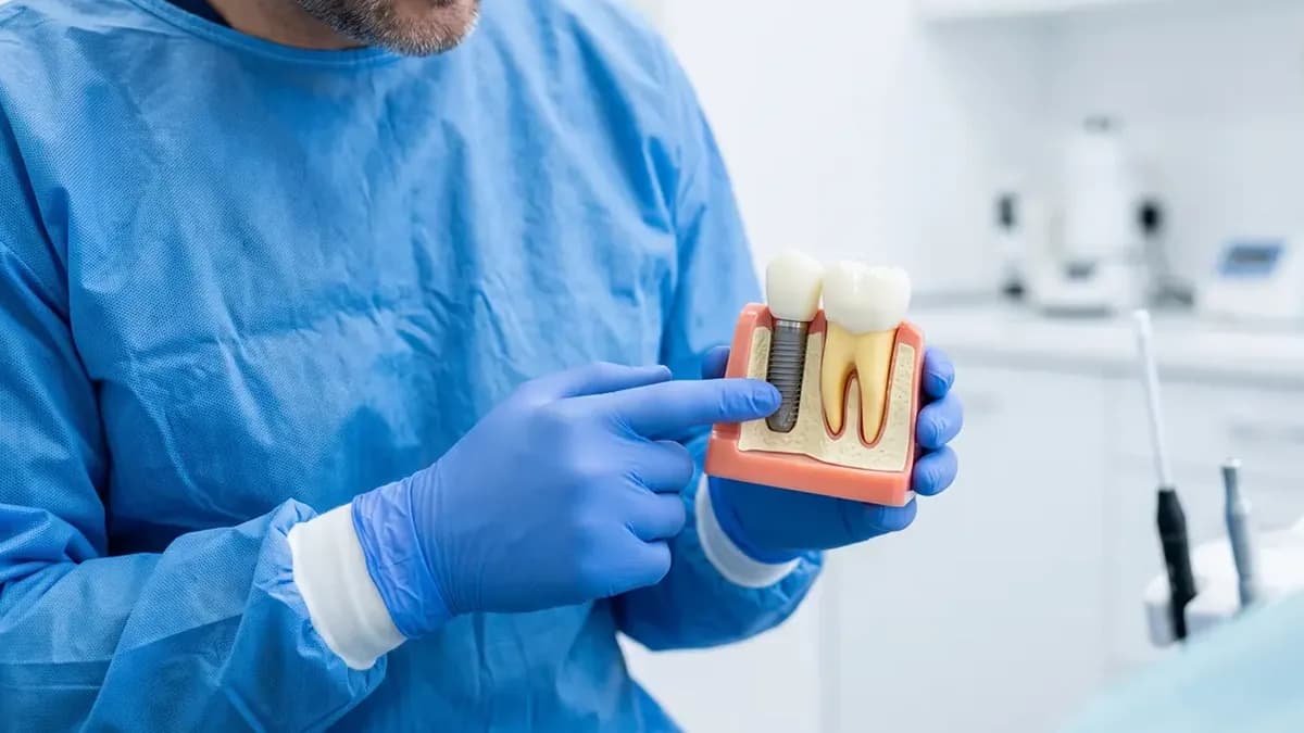 Cuánto cuesta un implante dental